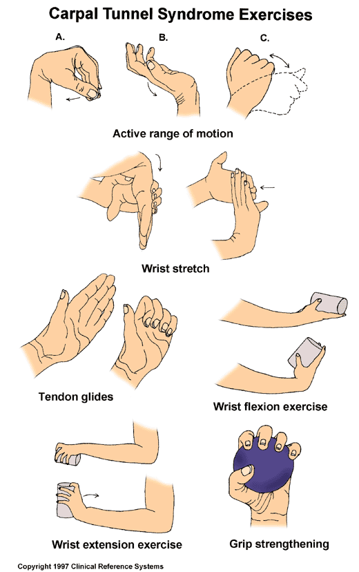 Carpal Tunnel Syndrome Wrist and Hand Exercises